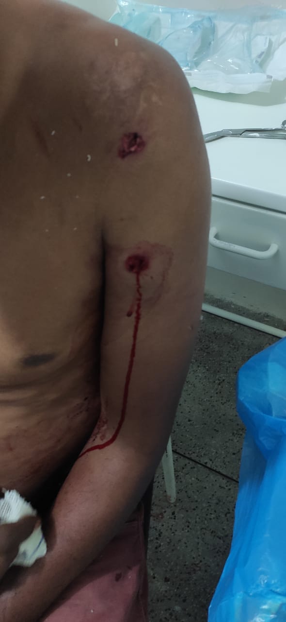 Acerto de contas: Vereador é vítima de atentado a bala em Canto do Buriti